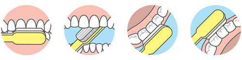 proper brushing of the front, back, inner and outer tooth surfaces