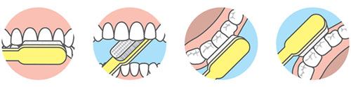 Correct toothbrushing technique