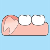 Dental instruments prepared for urgent care