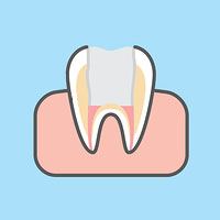 tooth filled with composite resin